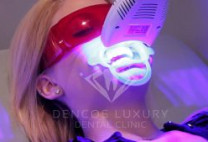 Tại sao bạn nên chọn phương pháp tẩy trắng răng Zoom Whitening tại Dencos Luxury?