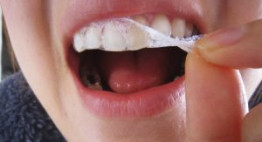 Tác dụng của miếng dán trắng răng thần kỳ đến mức nào?