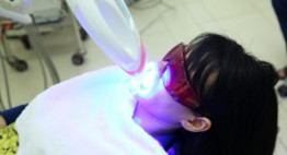 Tẩy trắng răng bằng Laser – Tất tần tật thông tin bạn nên hiểu rõ