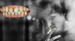 Cách làm trắng răng khi hút thuốc các chàng đừng bỏ qua