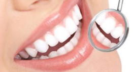 Zoom Whitening – Tẩy trắng răng công nghệ mới nhất