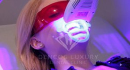 Zoom White Perfect: Công nghệ tẩy trắng răng hiệu quả được chuyên gia khuyên dùng