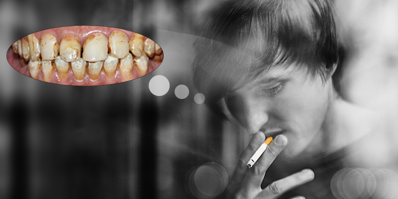cách làm trắng răng khi hút thuốc