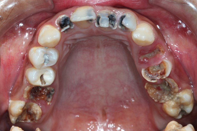 Cách chữa bệnh răng miệng hiệu quả 