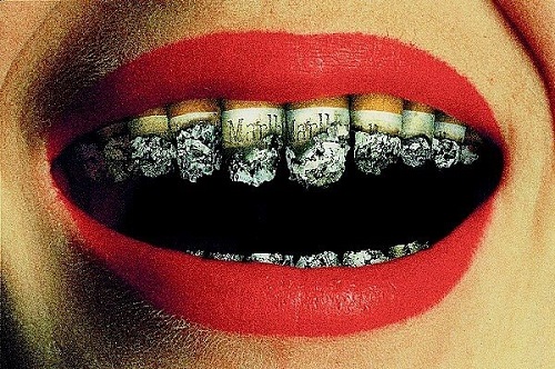làm trắng răng cho người hút thuốc lá